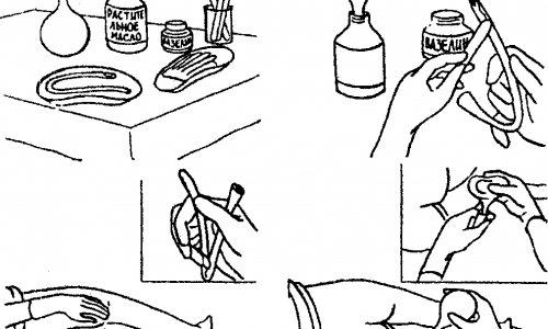 Клизма при запоре дома: когда нужна и как избежать риска
